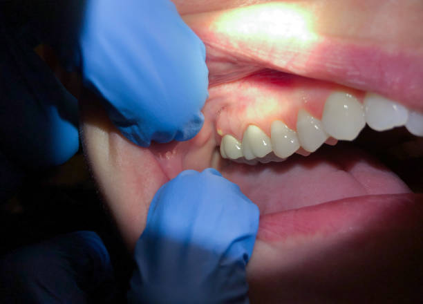 Best Emergency Denture Repair in Posen, IL